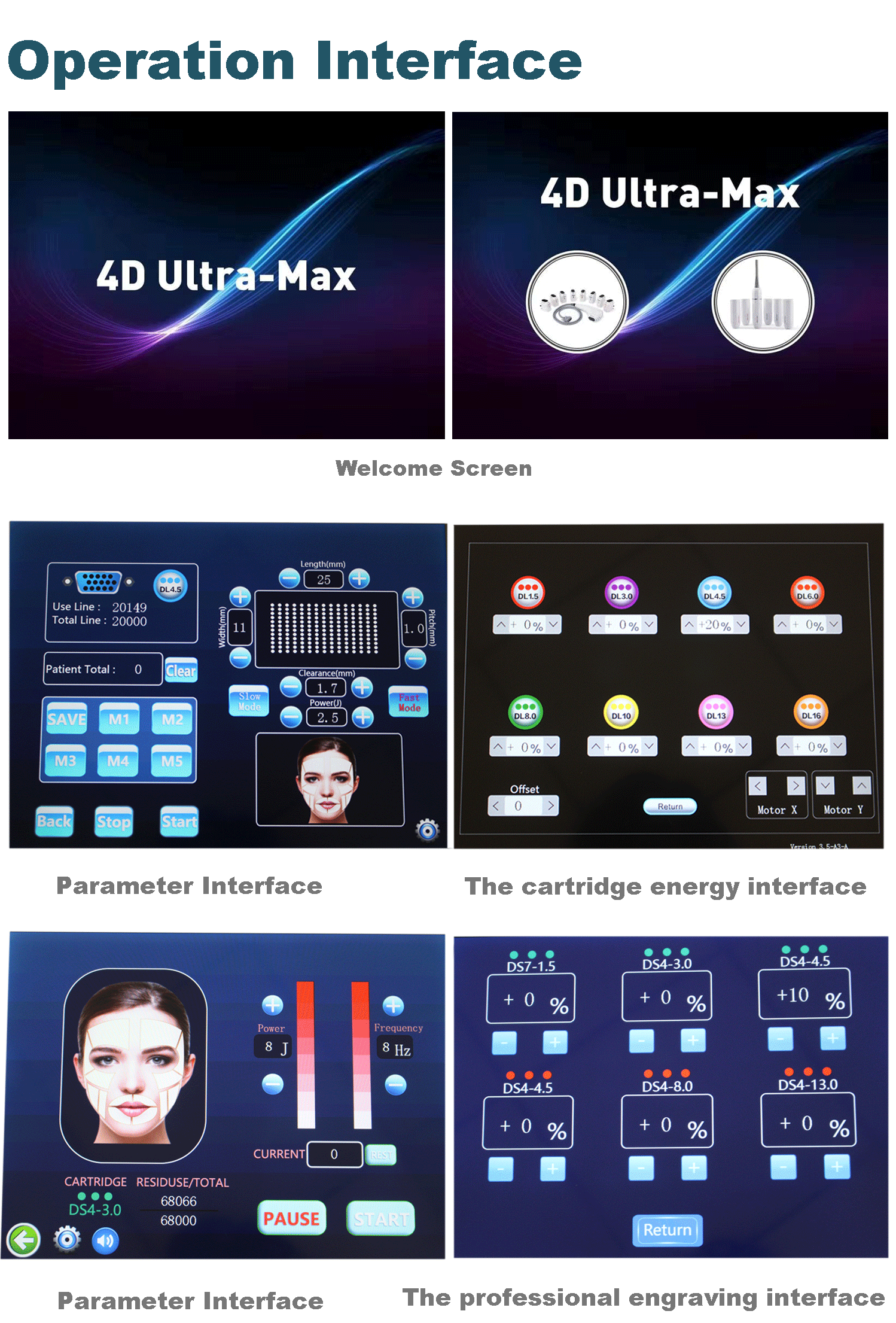 4DHIFU Beauty Machine System