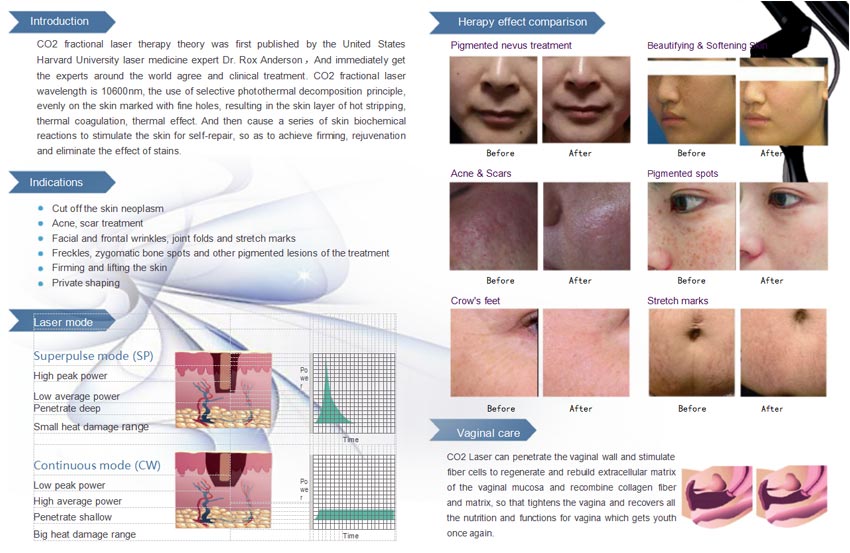 CO2 Fractional Laser equipument