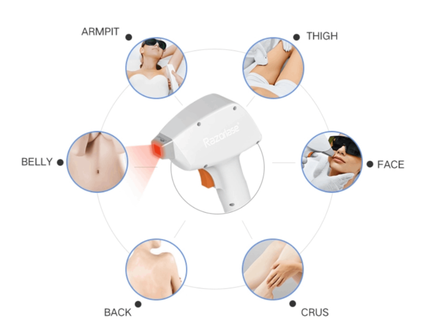 Diode Laser, Nd:YAG Laser and IPL Laser Comparison