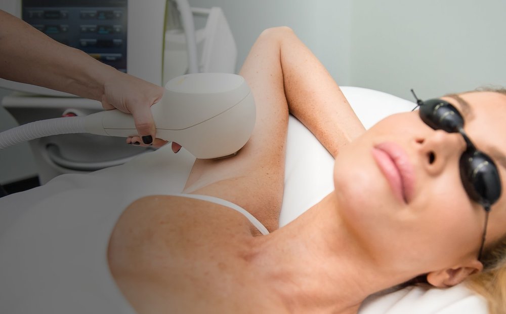10 questions for LPL hair removal treatment