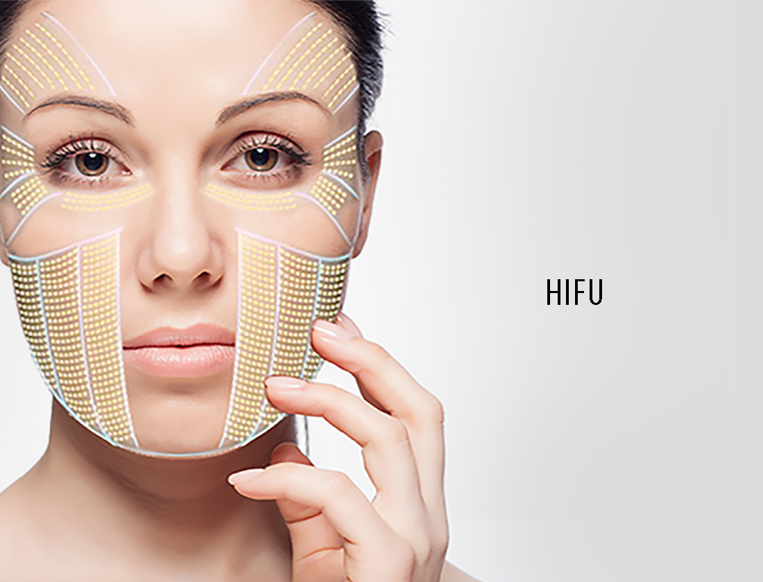 Is Hifu equivalent to Ultherapy?