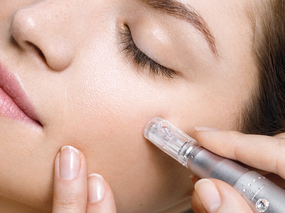 What I Wish I'd Known Before I Tried Microneedling