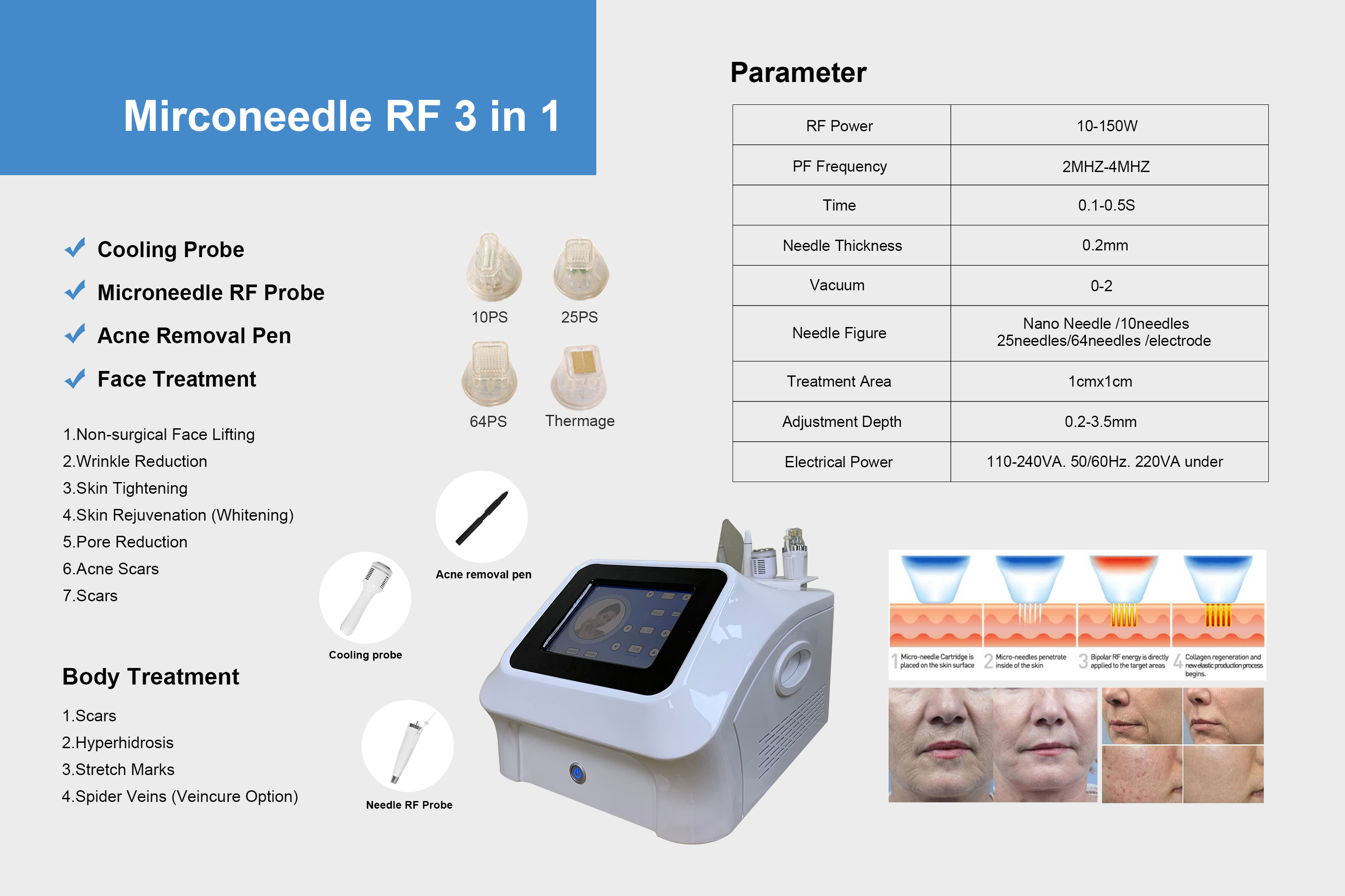 Mirconeedle RF.jpg