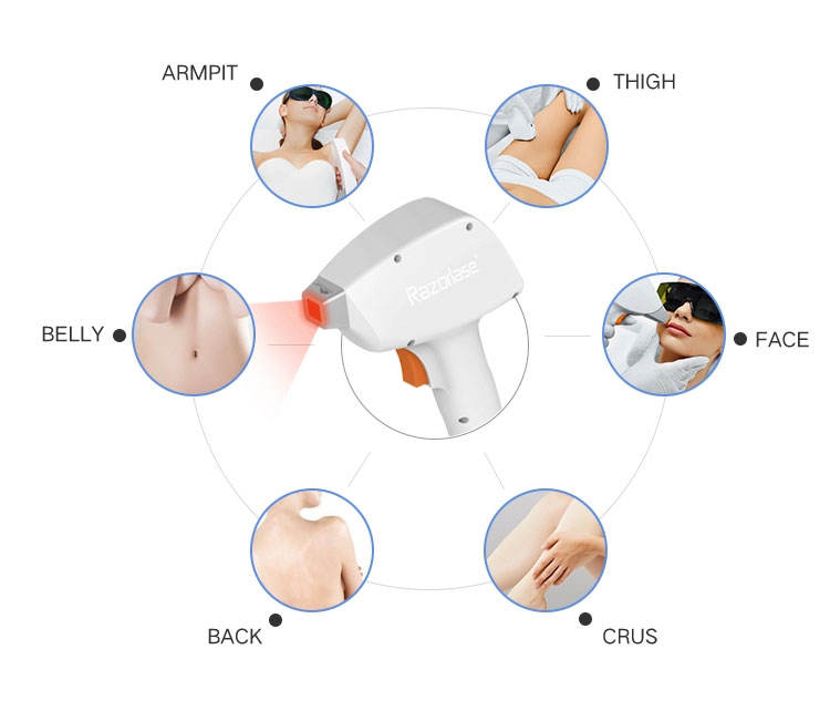 Portable Diode Laser Removal Machine