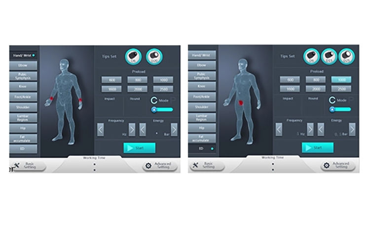 shockwave therapy portable ed machine