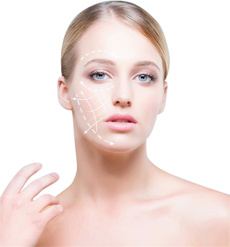 Symptoms of treatment after RF microneedling treatment