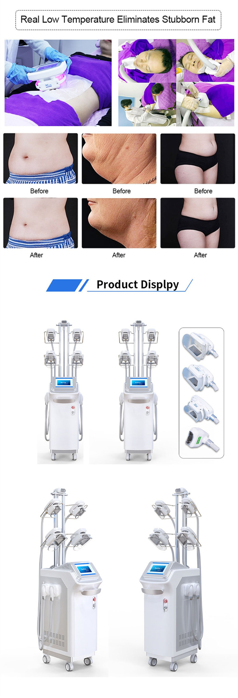 Body Contouring Beauty Machine