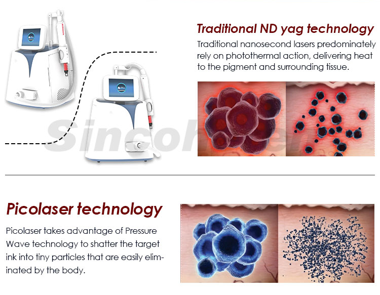 New Portable Pico Laser Tattoo Removal Skin Resurfacing Factory Machine