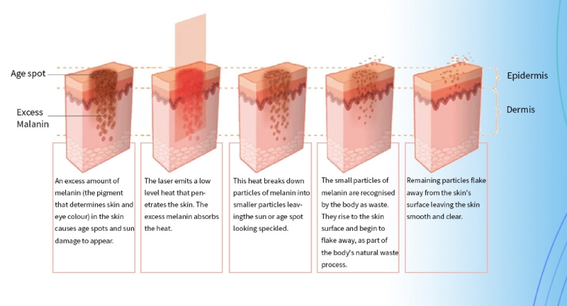 PDT LED Light Photodynamic Facial Skin Machine