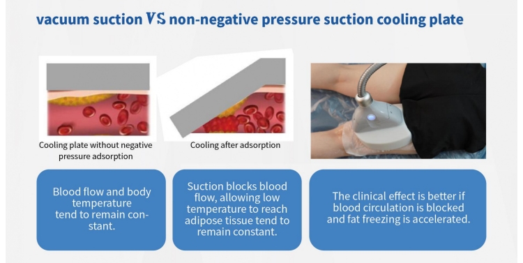 Cryolipolysis 360° Fat Sculpting 4 Handles Machine