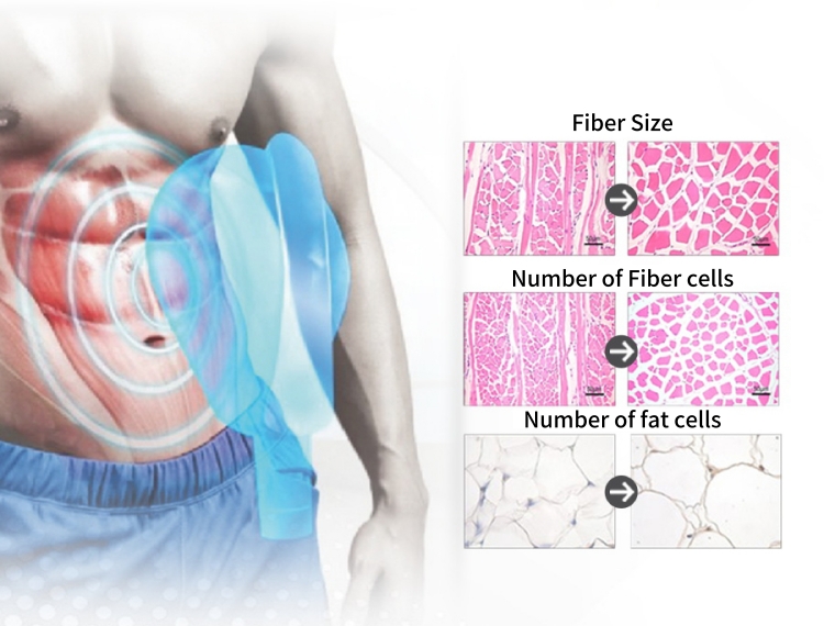 Coolplus Cryolipolysis EMS Fat Freezing Sculpting Machine