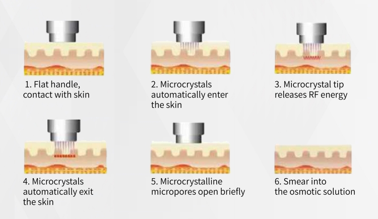 RF Microneedle Fractional Gold Machine