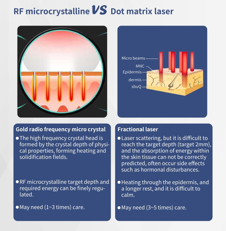 RF Microneedle Fractional Gold Machine