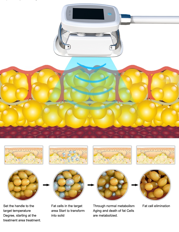 5 In 1 Cryoshape Fat Freezing Machine