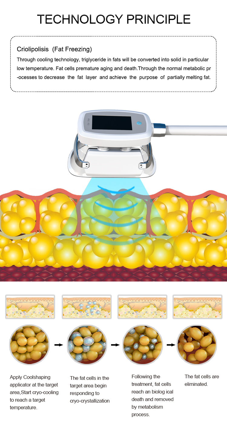 5 Handles Cryolipolysis Fat Removal Machine