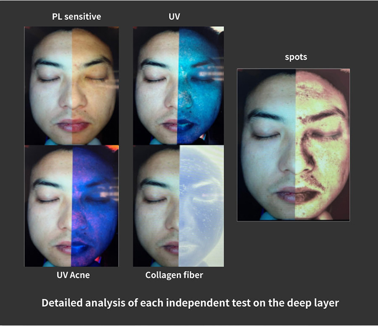Newest Intelligence Skin Analyzer HD Pixel