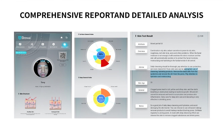 Newest Intelligence Skin Analyzer HD Pixel