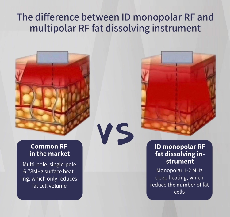 Monopolar RF ID Fat Dissolving Machine