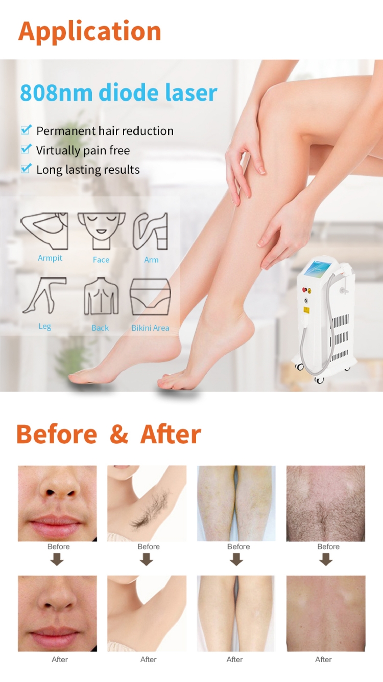 Diode Laser Perment Hair Removal Machine SDL-C