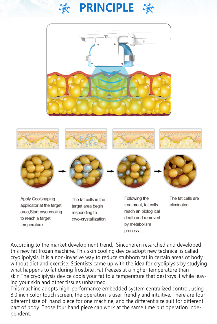 Does Cryo Slimming actually work?