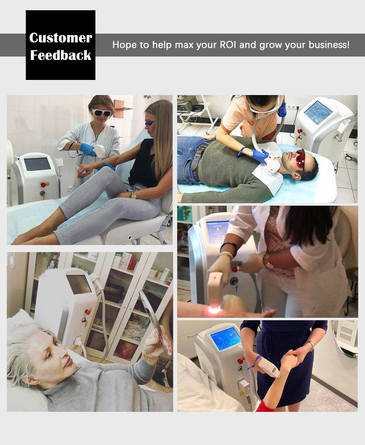 Which is better, IPL or diode?