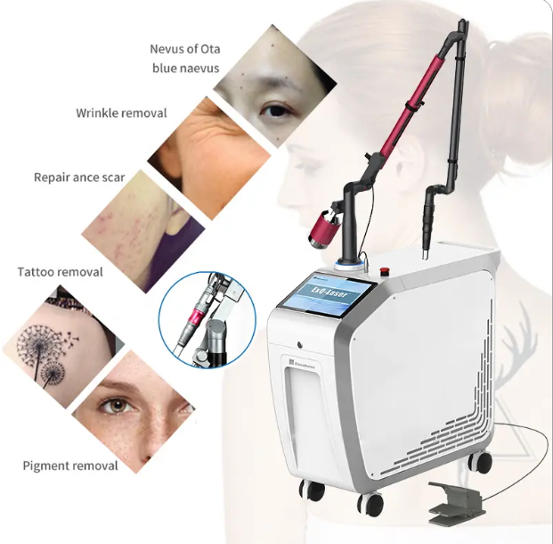 Is the Q-Switched ND YAG Laser Safe?