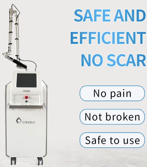 What Are the Benefits of Pico Laser?