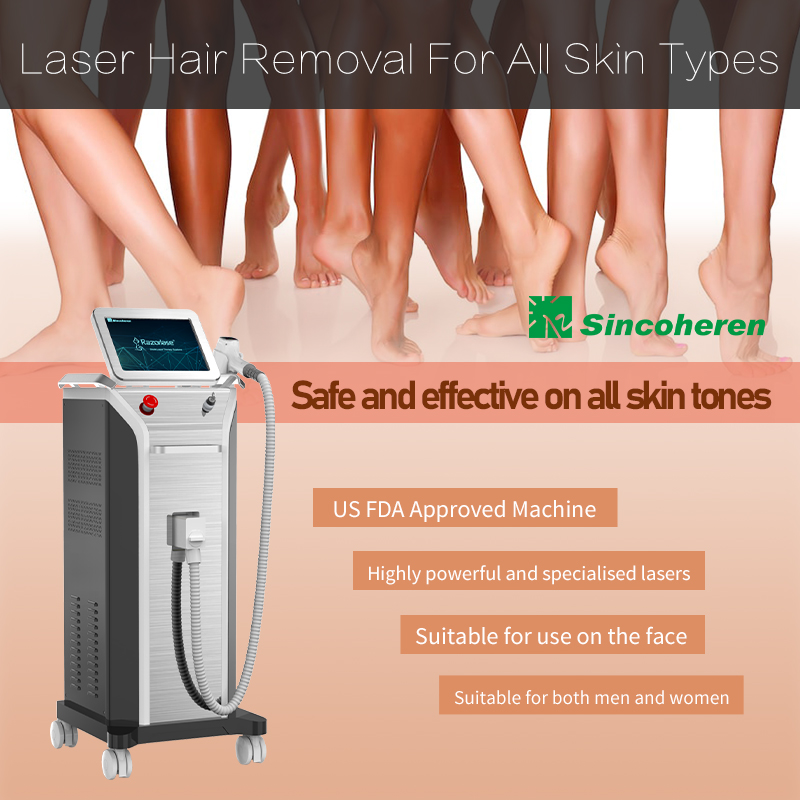 2000W laser hair removal machine