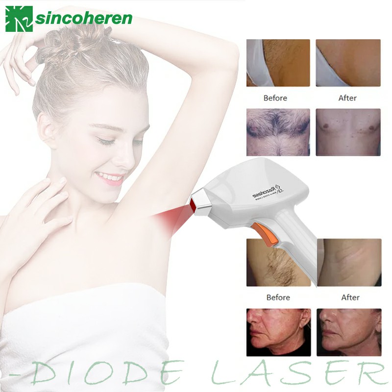 Razorlase Portable Diode Laser Hair Removal System