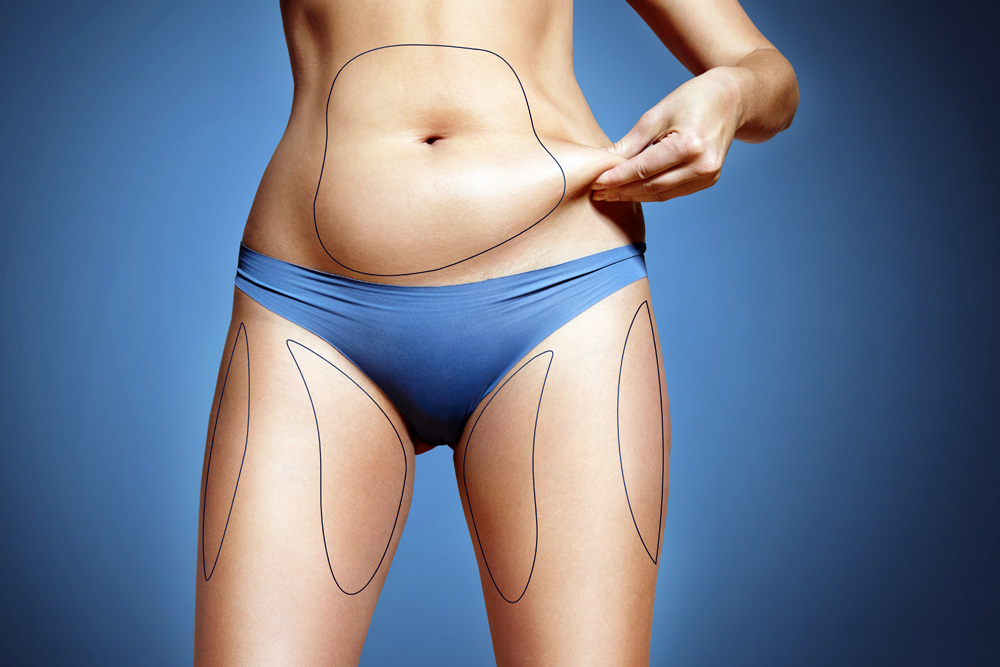 The Long-lasting Benefits of CoolSculpting for Body Sculpting