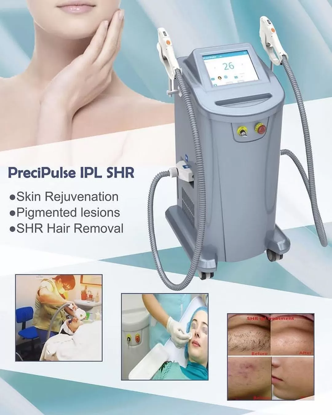 HIFU-Beauty-Machine