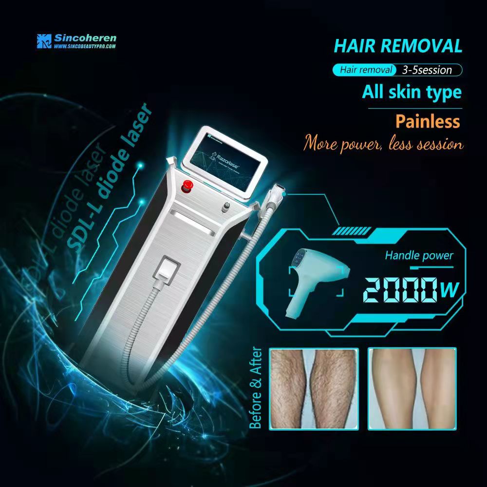 How Soon After Tanning Can You Get Diode Laser Hair Removal?